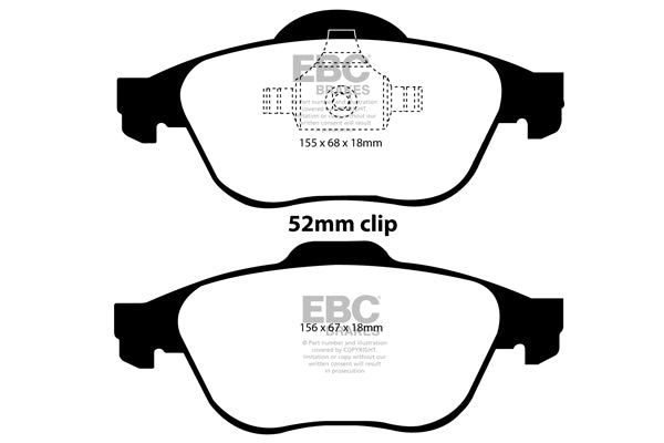 EBC Brakes Bundle – Front 280mm BSD Discs with Yellowstuff Pads – PD18KF110
